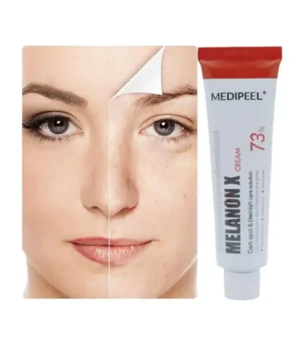 Melanon X Cream before and after results Bangladesh